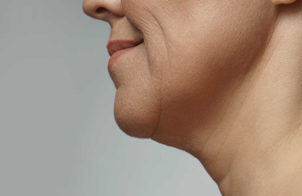 Program Oligio ช่วยเรื่องใดบ้าง